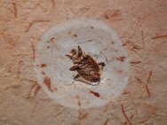 Beetle Insect Fossils